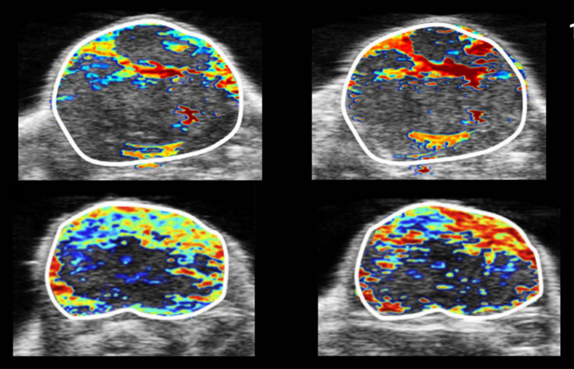 Unleashing the Clinical Potential of Photoacoustic Imaging