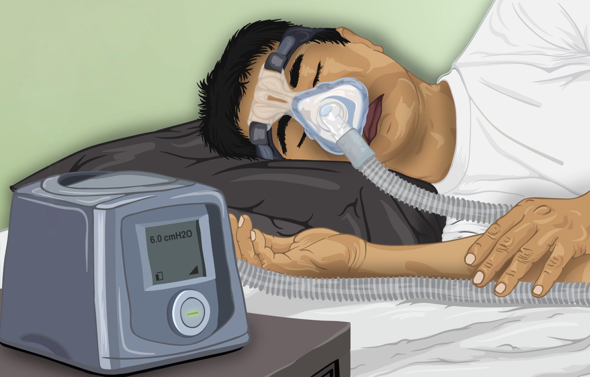 Sleep apnea